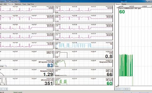 Dyna-Vision Cardio software