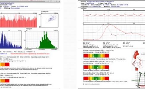 Dyna-Vision Health and Fitness software