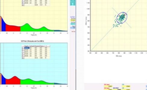 Dyna-Vision Research software