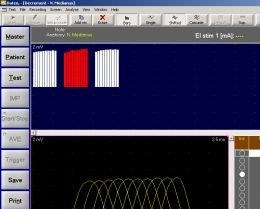 EMS Biomedical Surpass II software