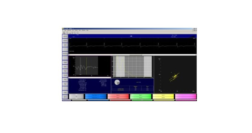 EMS Biomedical Surpass LT HRV