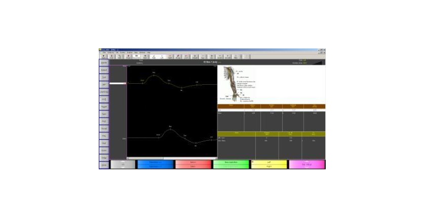 EMS Biomedical Surpass LT software MNC