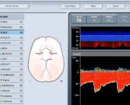 Viasonix Dolphin 4D interface