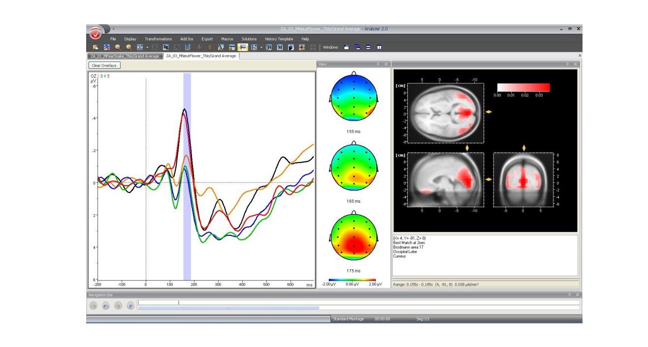 Brain Products BrainVision Analyzer Professional